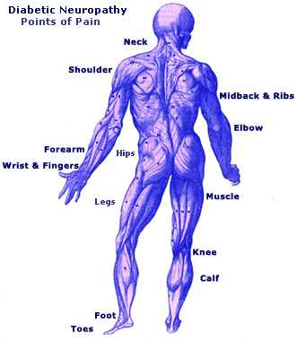 Chronic Neuropathic Pain